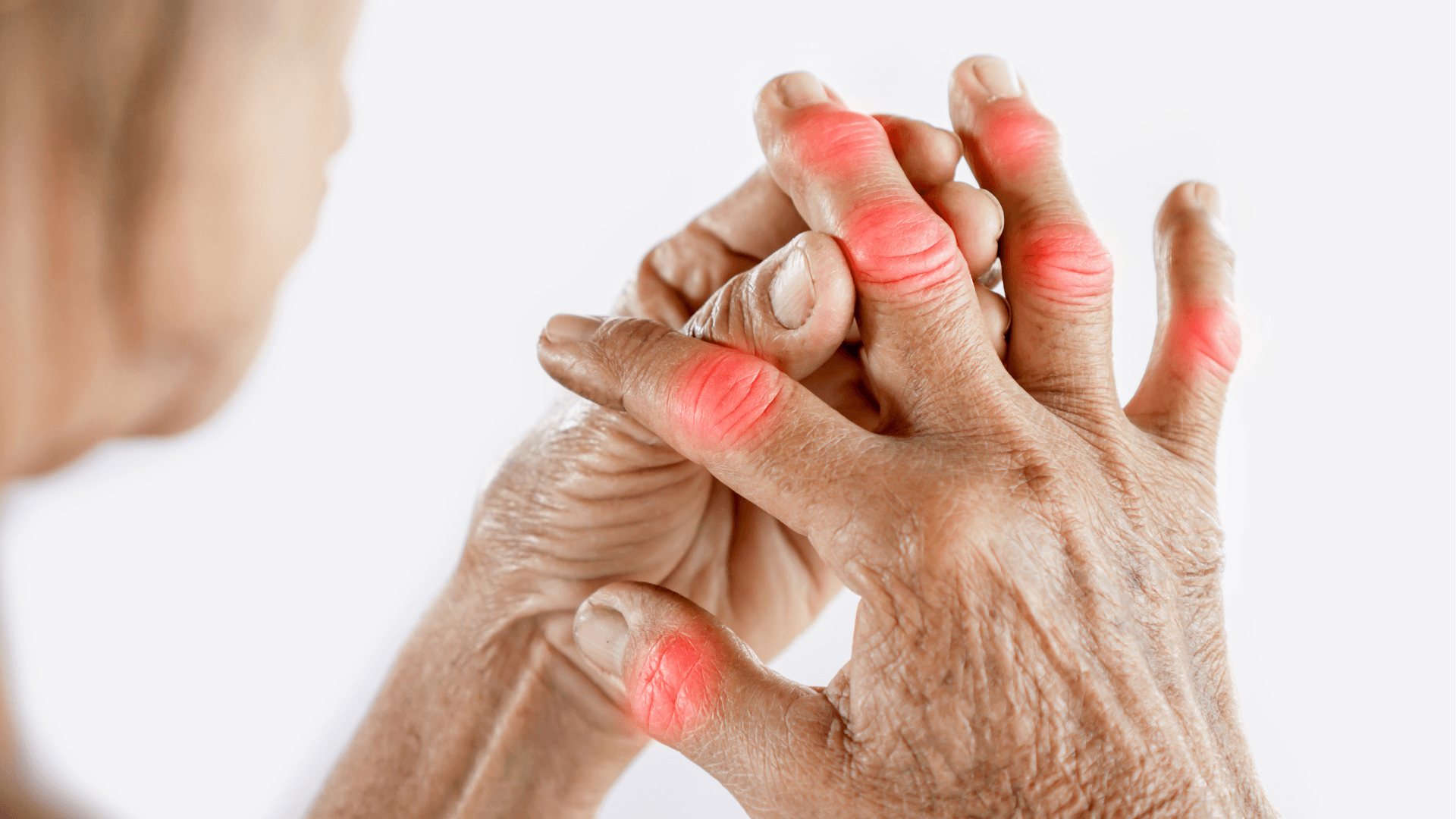 Arthritis Treatment in Ayurveda: A Holistic Guide