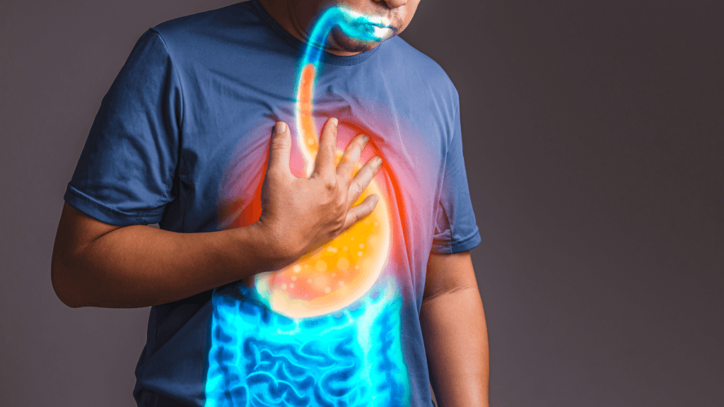 GERD Treatment in Ayurveda: A Comprehensive Guide